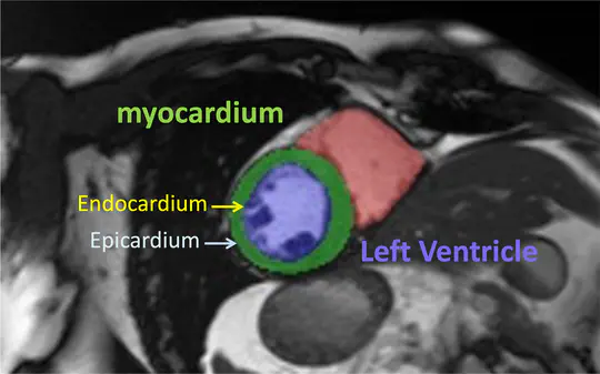 Cardiac Motion Analysis